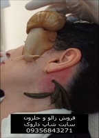 آموزش گذاشتن زالو و حلزون