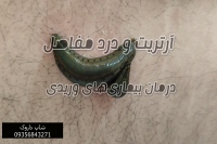 پک 20 عددی زالو طبی