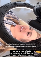 عوارض روکش دندان