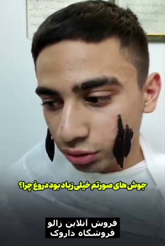 خواص زالودرمانی جوش صورت